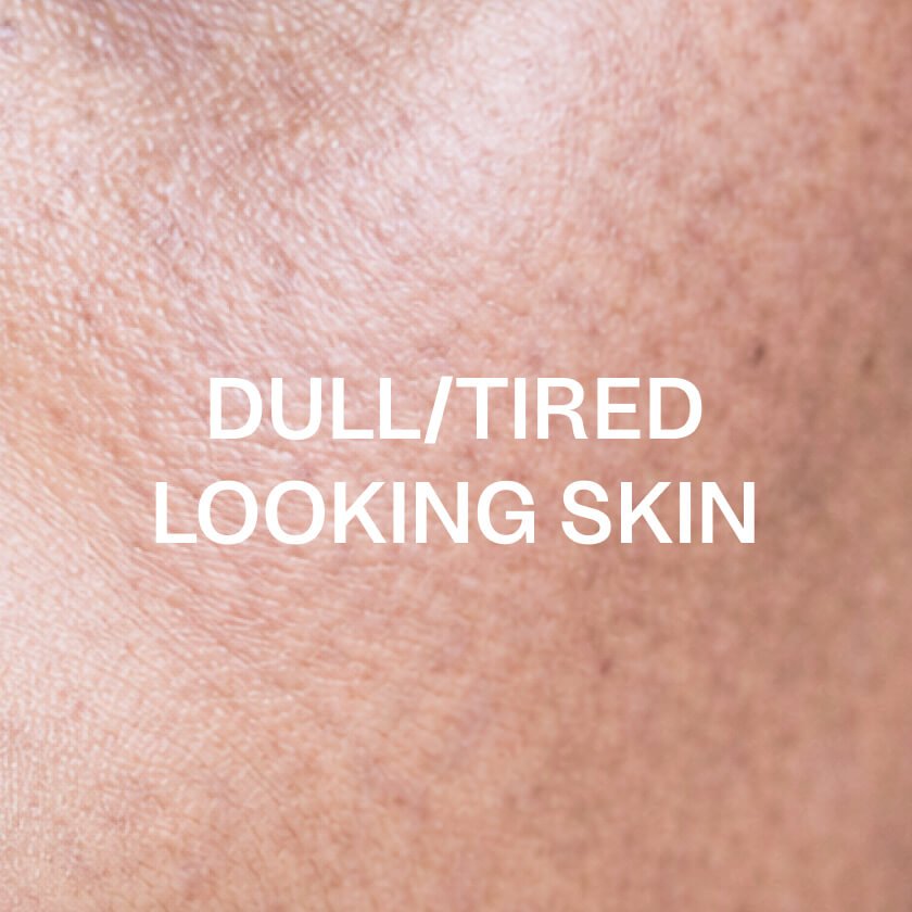 Skóra zmęczona lub poszarzała