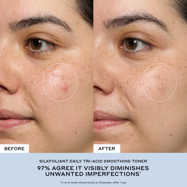 Transform Exfoliating Treatment Toner