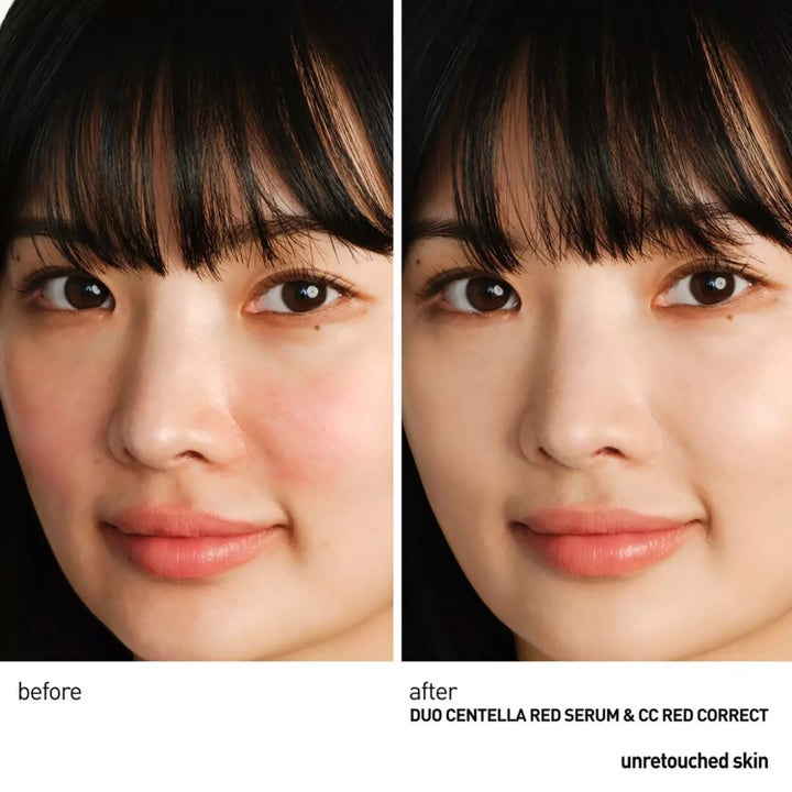 Centella Red Serum
