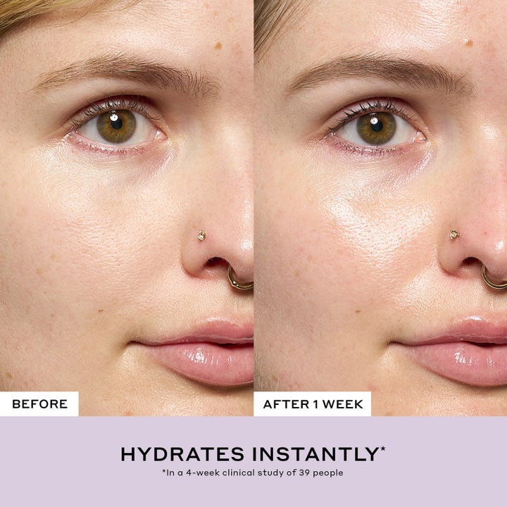 Strength Aprés-Skin Rich Rescue Treatment